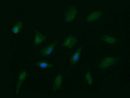 PTK2 Antibody in Immunocytochemistry (ICC/IF)