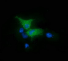 PTK2 Antibody in Immunocytochemistry (ICC/IF)