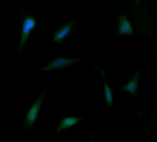 PTK2 Antibody in Immunocytochemistry (ICC/IF)