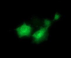 PTK2 Antibody in Immunocytochemistry (ICC/IF)