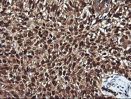 PTK2 Antibody in Immunohistochemistry (Paraffin) (IHC (P))