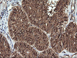 PTK2 Antibody in Immunohistochemistry (Paraffin) (IHC (P))