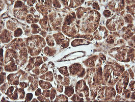 PTK2 Antibody in Immunohistochemistry (Paraffin) (IHC (P))