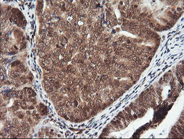 PTK2 Antibody in Immunohistochemistry (Paraffin) (IHC (P))