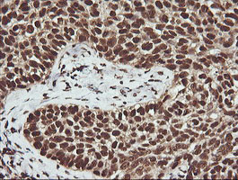 PTK2 Antibody in Immunohistochemistry (Paraffin) (IHC (P))