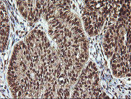 PTK2 Antibody in Immunohistochemistry (Paraffin) (IHC (P))