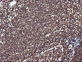 PTK2 Antibody in Immunohistochemistry (Paraffin) (IHC (P))