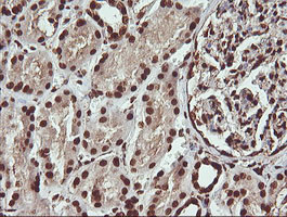 PTK2 Antibody in Immunohistochemistry (Paraffin) (IHC (P))