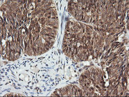 PTK2 Antibody in Immunohistochemistry (Paraffin) (IHC (P))