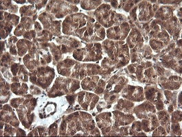 PTK2 Antibody in Immunohistochemistry (Paraffin) (IHC (P))