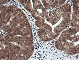 PTK2 Antibody in Immunohistochemistry (Paraffin) (IHC (P))