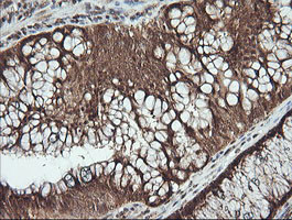 PTK2 Antibody in Immunohistochemistry (Paraffin) (IHC (P))