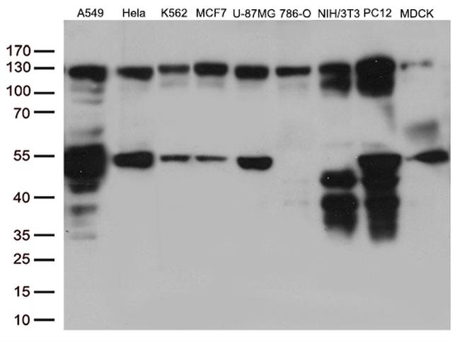 PTK2 Antibody in Western Blot (WB)