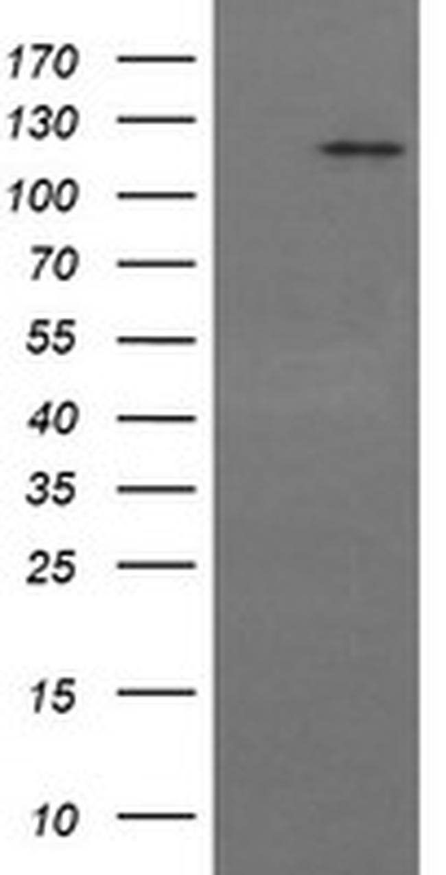 PTK2 Antibody in Western Blot (WB)