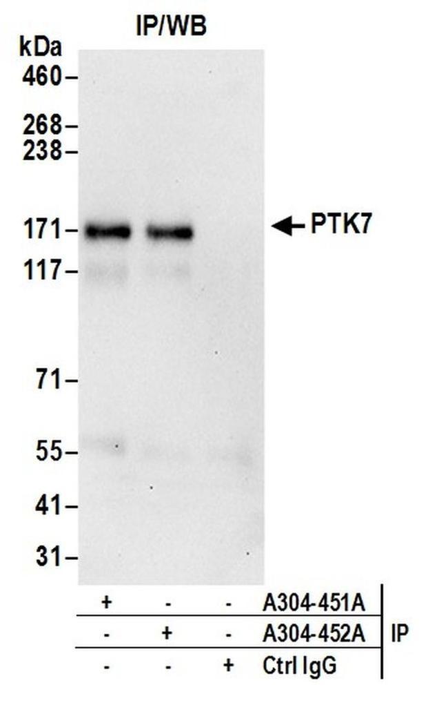 PTK7 Antibody in Western Blot (WB)