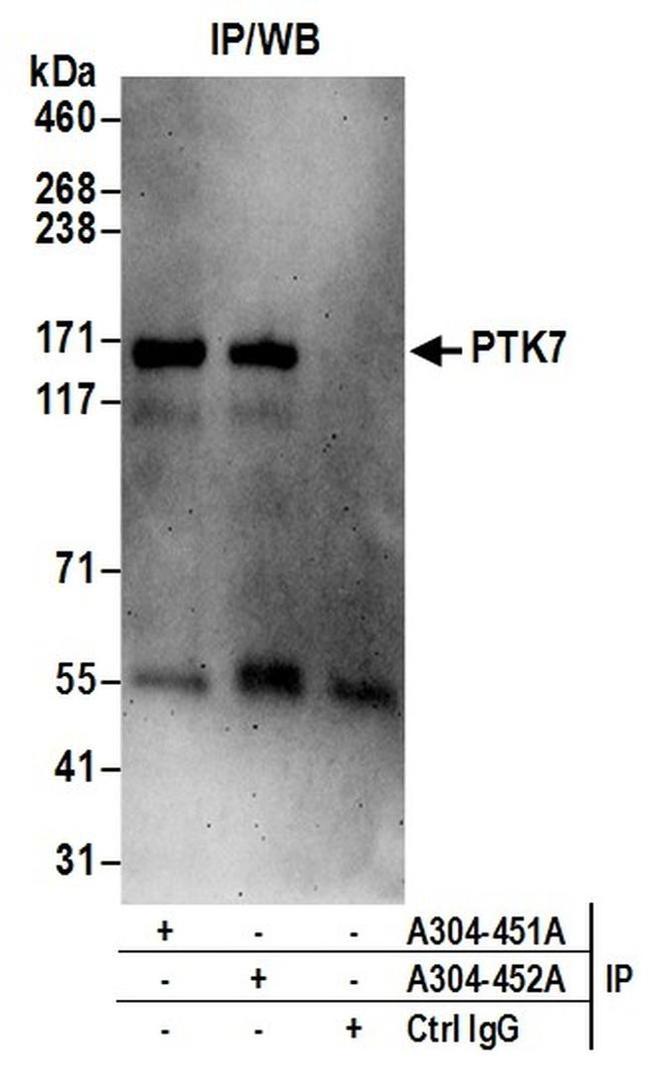 PTK7 Antibody in Western Blot (WB)