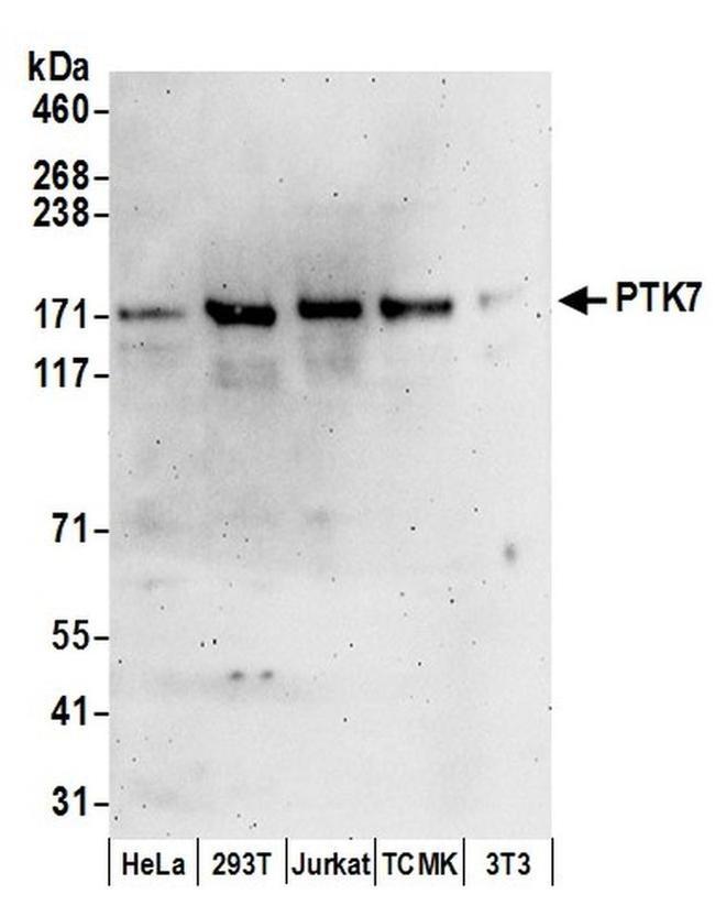 PTK7 Antibody in Western Blot (WB)