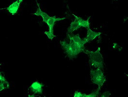 PTK7 Antibody in Immunocytochemistry (ICC/IF)