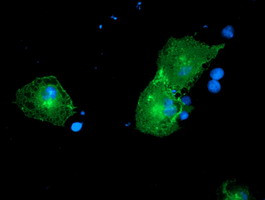 PTK7 Antibody in Immunocytochemistry (ICC/IF)