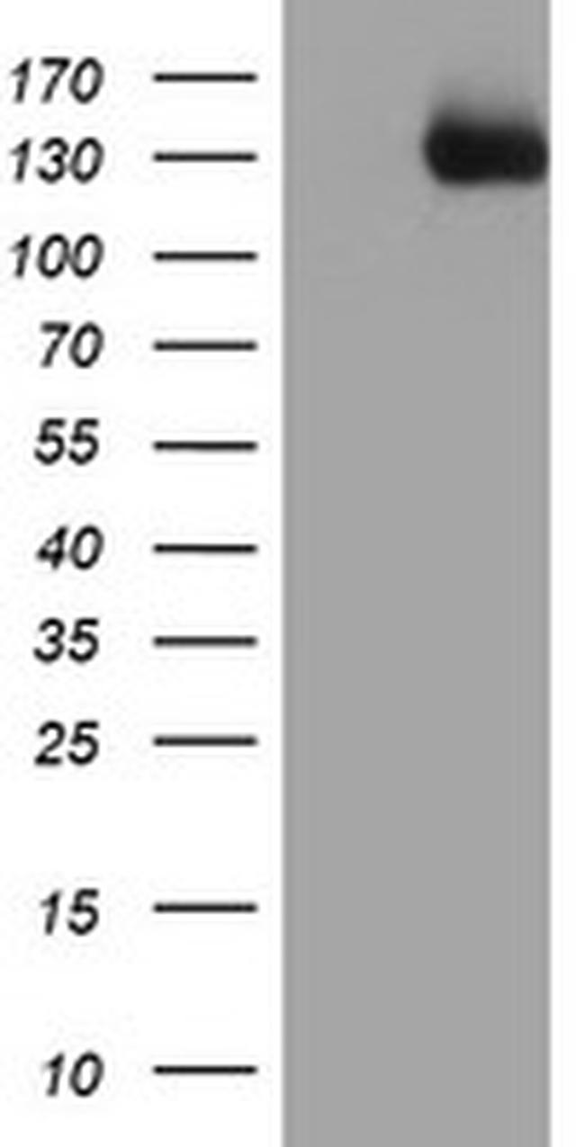 PTK7 Antibody in Western Blot (WB)