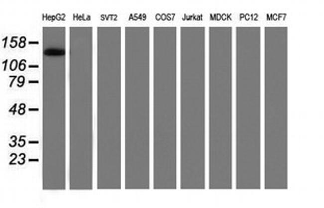 PTK7 Antibody in Western Blot (WB)