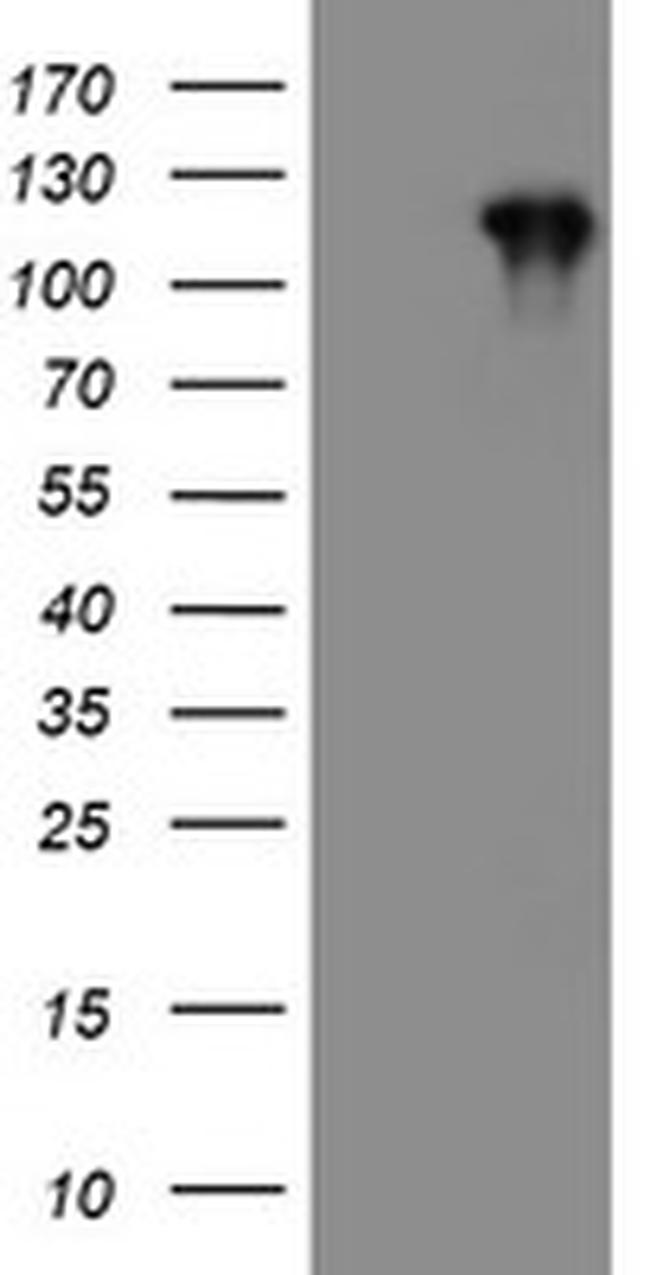 PTK7 Antibody in Western Blot (WB)