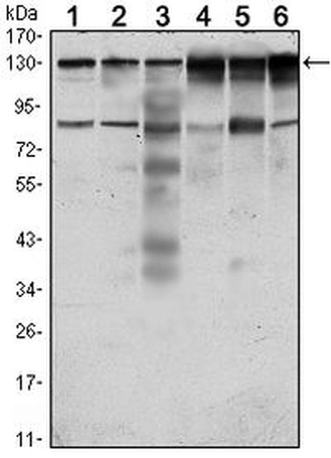 PTK7 Antibody in Western Blot (WB)