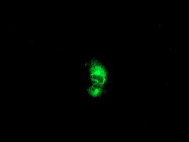 PTPN1 Antibody in Immunocytochemistry (ICC/IF)