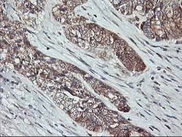 PTPN1 Antibody in Immunohistochemistry (Paraffin) (IHC (P))