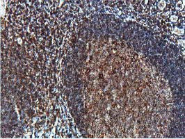 PTPN1 Antibody in Immunohistochemistry (Paraffin) (IHC (P))