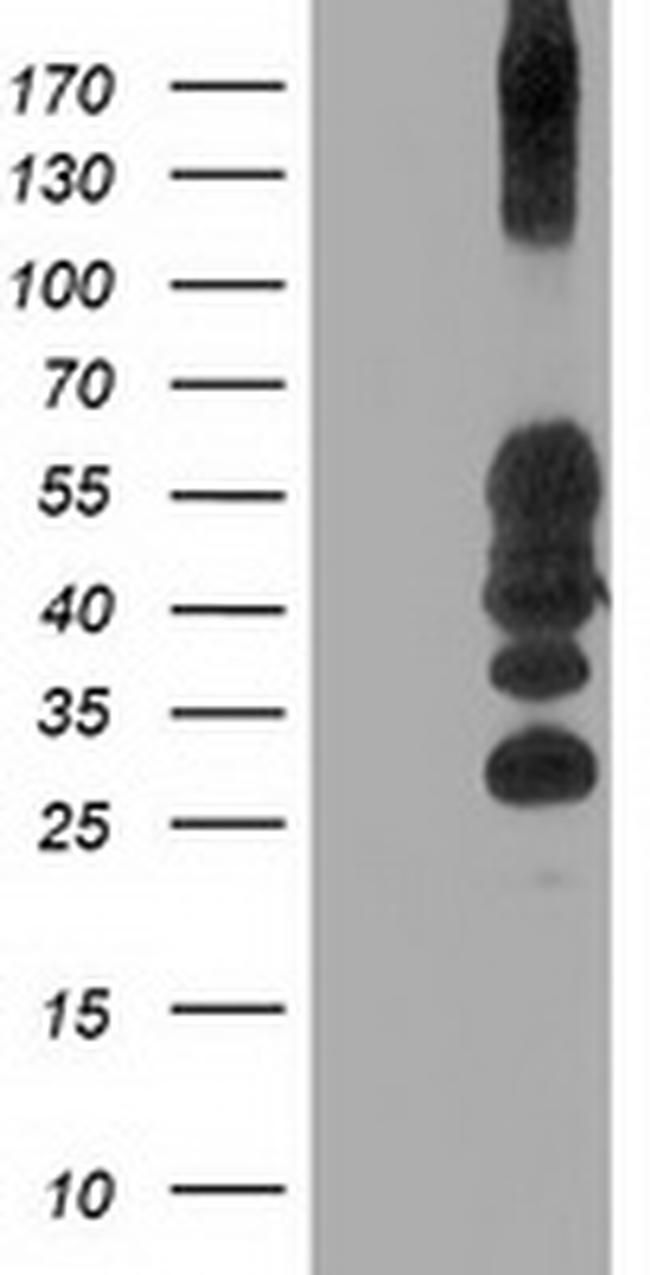 PTPN1 Antibody in Western Blot (WB)