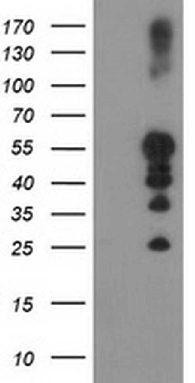 PTPN1 Antibody in Western Blot (WB)