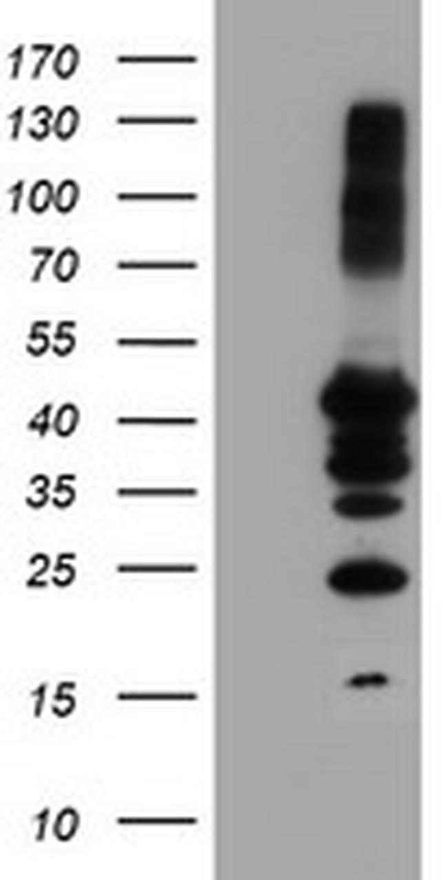 PTPN1 Antibody in Western Blot (WB)