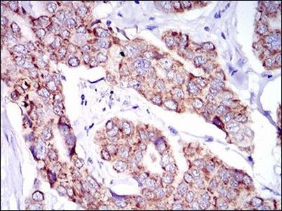 SHP2 Antibody in Immunohistochemistry (Paraffin) (IHC (P))