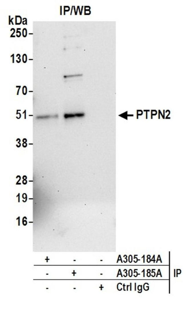 PTPN2/TCPTP Antibody in Immunoprecipitation (IP)
