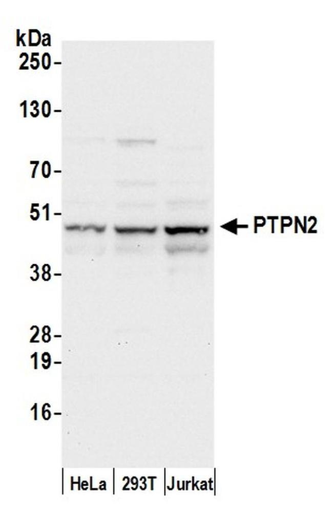 PTPN2/TCPTP Antibody in Western Blot (WB)