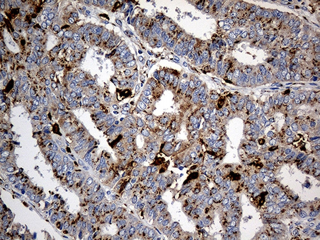 PTPN22 Antibody in Immunohistochemistry (Paraffin) (IHC (P))