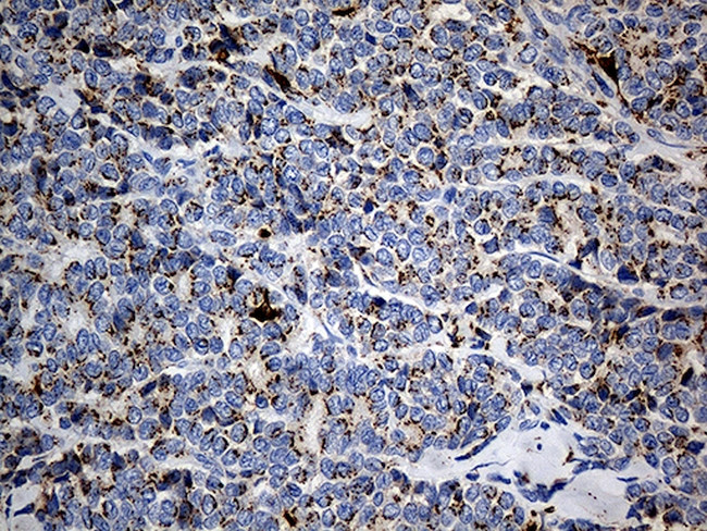 PTPN22 Antibody in Immunohistochemistry (Paraffin) (IHC (P))