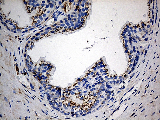 PTPN22 Antibody in Immunohistochemistry (Paraffin) (IHC (P))