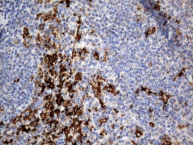 PTPN22 Antibody in Immunohistochemistry (Paraffin) (IHC (P))