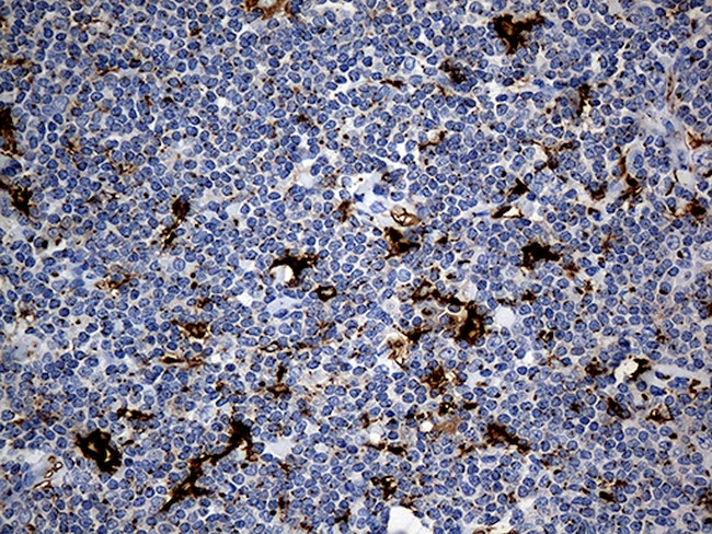 PTPN22 Antibody in Immunohistochemistry (Paraffin) (IHC (P))