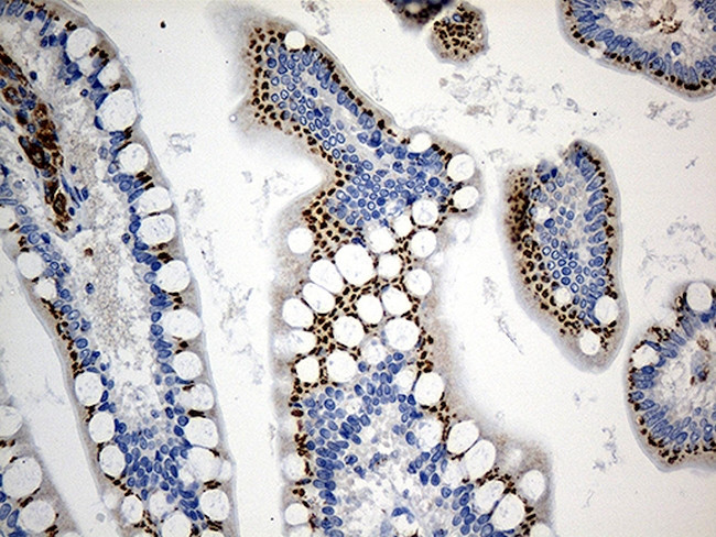 PTPN22 Antibody in Immunohistochemistry (Paraffin) (IHC (P))