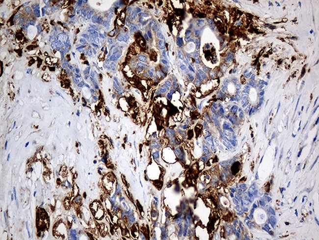 PTPN22 Antibody in Immunohistochemistry (Paraffin) (IHC (P))