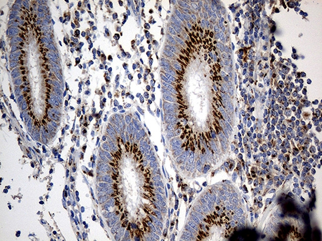 PTPN22 Antibody in Immunohistochemistry (Paraffin) (IHC (P))