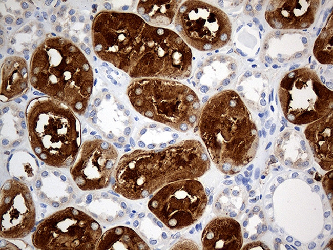 PTPN22 Antibody in Immunohistochemistry (Paraffin) (IHC (P))