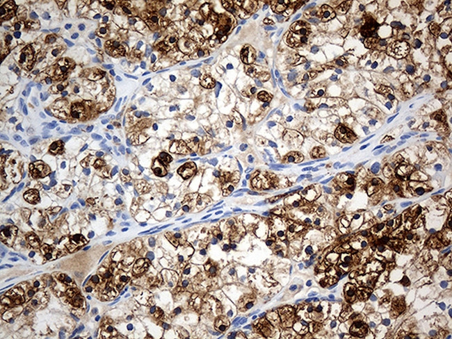 PTPN22 Antibody in Immunohistochemistry (Paraffin) (IHC (P))