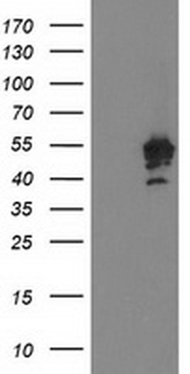 PTPN7 Antibody in Western Blot (WB)