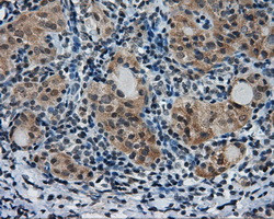 PTPRE Antibody in Immunohistochemistry (Paraffin) (IHC (P))