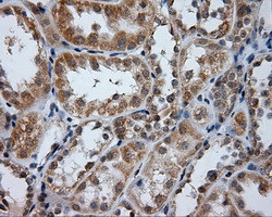 PTPRE Antibody in Immunohistochemistry (Paraffin) (IHC (P))