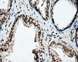 PTPRE Antibody in Immunohistochemistry (Paraffin) (IHC (P))